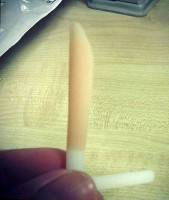 Nasal implants photos